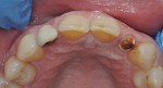 Fig 11. Preoperative occlusal view.