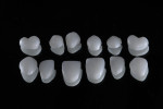 IDT Editorial Advisory Board member Pinhas Adar, MDT, CDT, will present a double-blind study comparing zirconia with lithium disilicate in six cases at next year's American College of Prosthodontics meeeting.