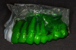 Fig 4. Bisacryl resin sheet vacuformed over STL model and trimmed to form the surgical guide.