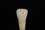 The primary anatomy, marked by the mesial facial and distal facial transitional line angles in blue, determines the anatomical crown shape. The secondary anatomy, marked in red, determines the macro surface texture as a consequence of tooth development.