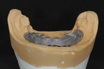 Fig 4. Milled implant bar from Panthera Dental.