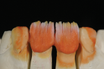 Fig 12. Secondary-fluorescence dentin.