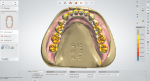 Fig 6. The Occlusion map slider can be used to view the distance between the neighboring teeth, as well as the distance for upper and lower jaws.