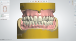Fig 12. Once approved, close Dental Designer and send the restoration for production.