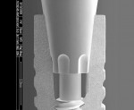 Figure 1  SEM image of Morse-taper connection ANKYLOS implant.