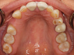 Photographs of existing dentition to be used for treatment planning.