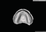Fig 4. Scans of the mandibular and maxillary
impression in STL format.