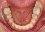Fig 3. Photographs of existing dentition to be used for treatment planning.