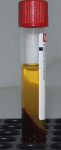 Fig 2. Fibrin clot (yellow) in the tube following centrifugation.