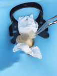 The tooth is disinfected and prepped prior to cementation.