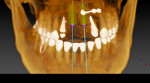 Fig 2. CBCT data provides a 3D representation of hard tissues.