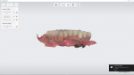 Fig 1. The patient presents with an existing full mandibular arch restored with a porcelain-fused-to-metal restoration.
