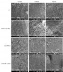 Fig 3. Representative SEM images of each experimental group. Original magnification is 1000X. OS = observer score. SS = software score (closed tubule percentage).
