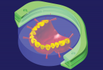 Fig 7. The design is imported into hyperDENT software to develop milling strategies for the digital denture.