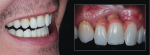 Fig 24. The combination of extraoral and intraoral images helps to establish the pre-operative situation.
