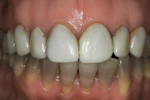 Figure 2  Pre-treatment view, facial view.