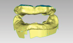Fig 3. Maxillary and mandibular dentition virtually extracted at gingival margin line.