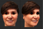 Fig 4. Images showing the face scan of the smile position with the virtual teeth adjusted following dimensions and positions in relation to the midline, interpupillary line, and desired width over length ratio.