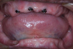 Fig 1. Initial intraoral situation.