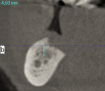 Fig 17. Preoperative CT scans.