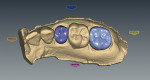 Figure 7  An occlusal view was taken of the designed CAD unit, which was ready for adjustments and approval.