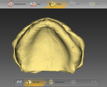 Fig 4. After scanning, the impressions are converted to an STL file ready for digital denture design.