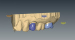 Figure 8  A facial perspective of the CAD units was created and ready for approval.