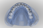 Fig 18. With transparency overlays both maxillary and mandibular tooth arrangements can be viewed from a superior or inferior perspective showing ridge, teeth, and centric occlusion.
