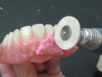 Fig 25. With a conventional, digital or integrated workflow the finishing and polishing process remains the same. There might be more or less finishing and polishing depending on processing technique although the eyes and hands of a technician make detailed finishing touches on the complete denture at the end of all workflows.