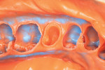 Detailed view of the facial and distal margins.