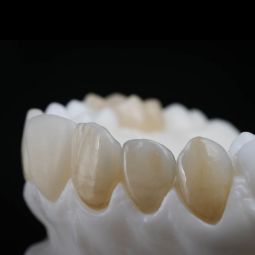 Zirlux Anterior Multi by Zahn Dental