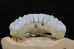 Fig 4. Lithium-disilicate crowns in blue phase. Crowns were designed in CAD software and milled on the Versamill 5XS.