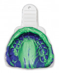 The hydrophilic and flowable material
properties of Splash Max allow clinicians to capture detailed, distortion-free impressions,
ensuring quality margins, fit, and function for all of their lab cases. Splash Max is offered in
bright colors to provide a sharp contrast when used together, making it easier for the clinician
and lab to visualize the fine details.