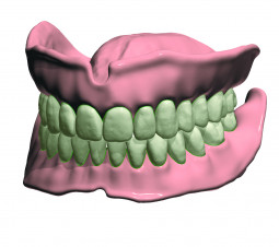 Denture Design™ by 3Shape Inc.