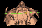 Fig 2. Computerized implant planning: anterior vision (Fig 1), view from below (Fig 2).