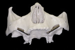 Fig 13. Simulation on the model. Placement of the training zygomatic implants onto the tridimensional model.
