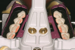 Figure 5&ensp Filou 28 Denture set-up system: maxillary teeth-jig assembly. Mondial<sup>®</sup> teeth.;