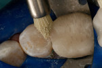 Figure 10  Achieving the final luster with a silicone brush.