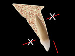 Fig 18. Ideal pattern of eruption along the long axis of the tooth with no facial or palatal compressive forces.