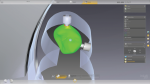 Fig 12. New tools can double-check any restoration milled on a Dentsply Sirona mill.