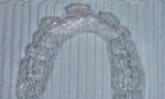 A “single-tooth” bleaching tray allows the bleaching of one tooth without changing the color of the adjacent teeth until the final shade of the single tooth is determined.