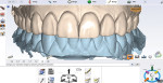 The Planmeca Romexis software allows dentists to design everything from surgical guides to smile design models.