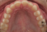 Figure 8  Occlusal view of the maxilliary arch.