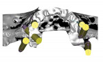 CBCT view of implant planning software. The 3D visualization of osseous structures assists in planning the placement of additional implants utilizing native bone sites.