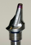 Figure 2  A 15° prefabricated esthetic abutment facing the base of the triangle for correction of a malpositioned implant.