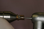 Figure 6  A chamfer is established using a 1556 carbide bur; connecting depth cuts made.