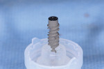 Fig 5. The 4.5-mm diameter implant used for tooth No. 14.