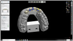 Dynamic Abutment Solution from Preat Corporation