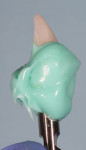 Fig 10. Example of a custom abutment transfer from a different case. Bite registration material placed around the crown/abutment/analogy.