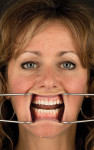 A retracted full-face image offers an unobstructed view of the position of the dentition as it relates to the face and can be used to superimpose smile designs.